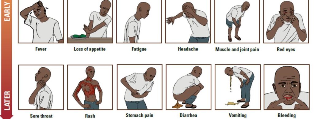 What You Need to Know About Ebola